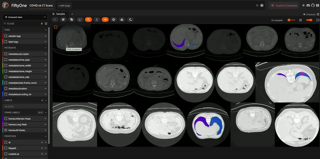 Medical Imaging