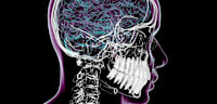Close up x-ray view of a closed mouth. This image highlights the teeth in the jaw with no surrounding tissue or muscle.