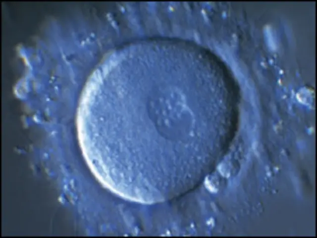 Fertilización (Science Photo Library)