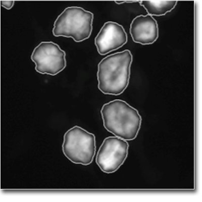 CellProfiler Leukemia Human Megakaryocytes