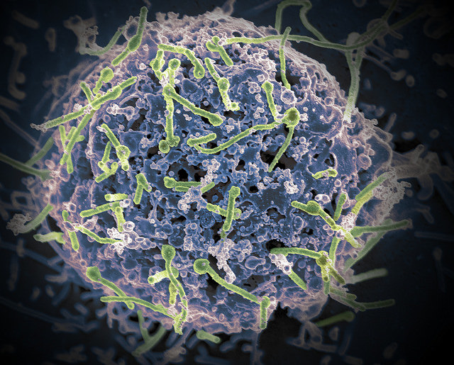 Ebola Virus from Mali Blood Sample